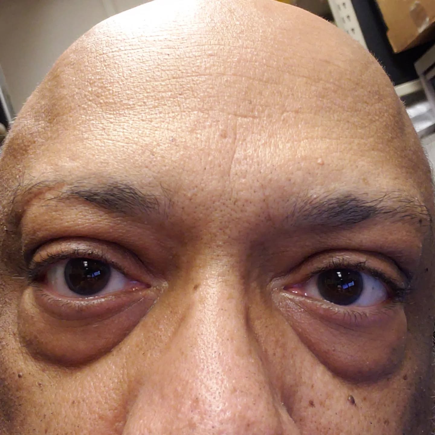 Good morning.I remember a time when I didn't have bags under my eyes. It seems like a long time ago, but I remember the time.Have a good day today!
